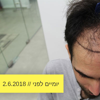 Read more about the article יומיים לפני