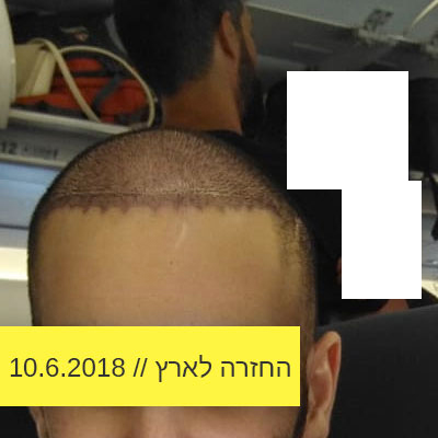Read more about the article החזרה לארץ