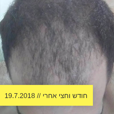 Read more about the article חודש וחצי אחרי