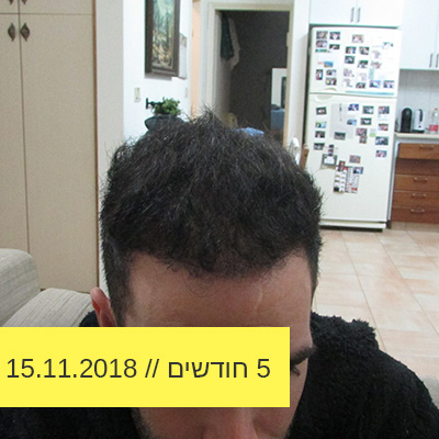 Read more about the article 5 חודשים אחרי