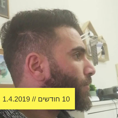 Read more about the article 10 חודשים אחרי