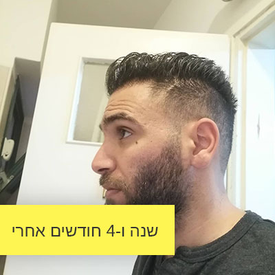 Read more about the article שנה ו-4 חודשים אחרי